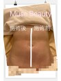 ミューズビューティー(muse beauty)&nbsp;最新型ハイパーナイフ