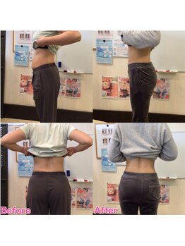 整体院 トトノウ(TotonoU)/キレイになった方が続出！！