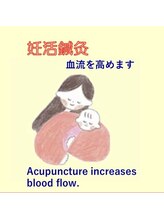 かつらはりきゅう 小児しん/妊活にも鍼灸は効果あります。