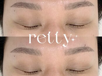 レッティー(retty)の写真/≪清潔感を手に入れる人気のハイグレードマシンで違いを実感≫痛みの少ない脱毛×美肌×美眉の本格ケア！