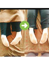 サプライズ整体院/30代ママさんの産後の骨盤初回