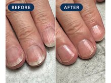 マニネイルケア 新宿店(maninail CARE)/ネイルケア