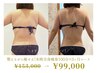 【モニター様募集!!】見た目-5kg★本格全身痩身100分 3ヶ月コース ¥153,000→