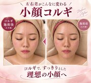プチ ビサージュ ポワール(Petit Visage Poire)