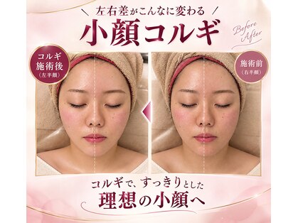 プチ ビサージュ ポワール(Petit Visage Poire)の写真