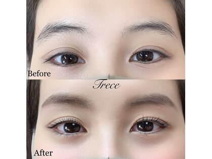 トレセ 尾山台(Trece)の写真