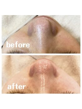 シエル(ciel)/before→after