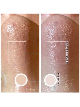 ピュアトゥルー 岐阜西店(PureTrue)/アクアピール