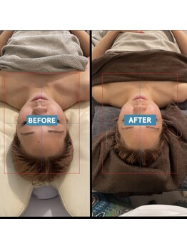 キヅク/before→after お顔