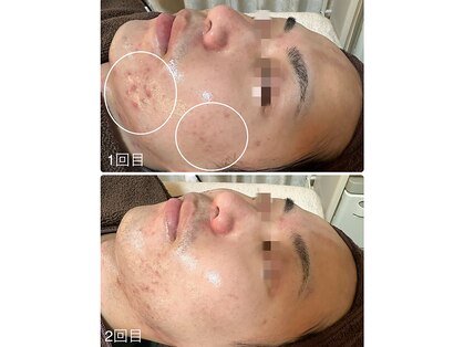ニコリ 大宮(NICORI)の写真