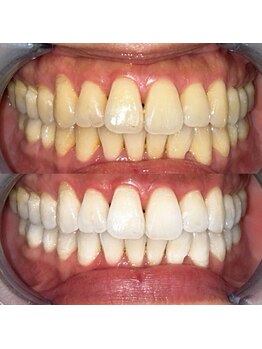 ライトビューティー 池袋店(LightBeauty)/症例写真