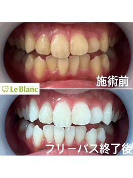 ルブラン 奈良店(Le Blanc)/黄ばみとるなら