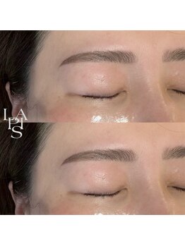 フレイズラピス(FRASE Lapis)/ハリウッドブロウリフト