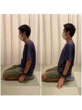 ツリー鍼灸整骨院 吹田店(TREE鍼灸整骨院)/スポーツによるお悩みなども