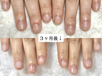 グラシナ 鳥丸店/急な予定にも2時間で綺麗に