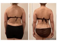 ボーテ(beaute)/【肋骨ケア】