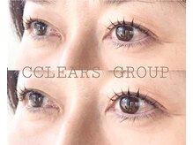 クリアーズ ビューティー(CCLEAR’S BEAUTY)/