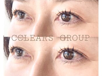 クリアーズ ビューティー(CCLEAR’S BEAUTY)/