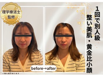 小顔美肌ファクトリー 梅田院の写真/素肌から変わる印象美◇理学療法士監修の肌質改善フェイシャル×小顔ケア