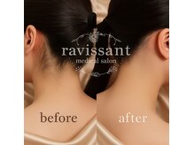 ラヴィソン(ravissant)
