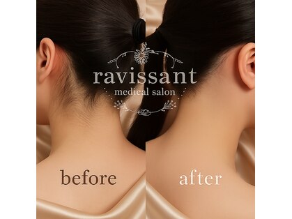 ラヴィソン(ravissant)の写真