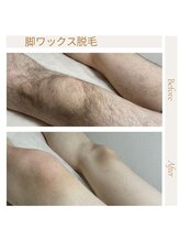 オフオルファヴォリ(OF Olu:Favori)/【フラッシュワックス脱毛】