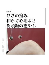 ままの森鍼灸マッサージ院/ひざに灸頭鍼