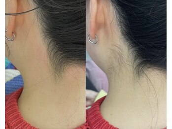 ハリウッドブロウリフト ワクシー 自由が丘店(HOLLYWOOD BROW LIFT WAXYYY.)/うなじワックス