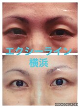 エヴァーグレース 横浜店/目元専用マシンを使用♪