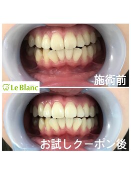 ルブラン 奈良店(Le Blanc)/20代が圧倒的!!