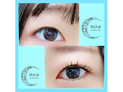 ノア(noa)の写真