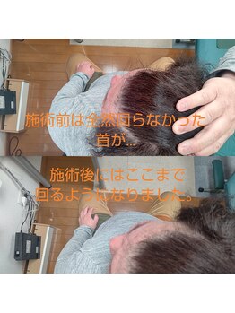 シャロームカイロプラクティックおおば/肩こりで首が回らない【カイロ】