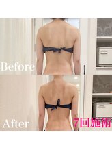 えすてさろん ケイアンドエフ(k&f)/【美姿勢】ラインまでも美しく