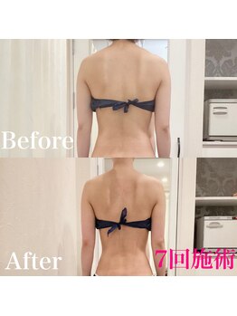 えすてさろん ケイアンドエフ(k&f)/【美姿勢】ラインまでも美しく