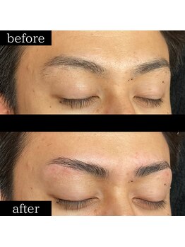 ユー 千葉駅前店(you)/症例写真