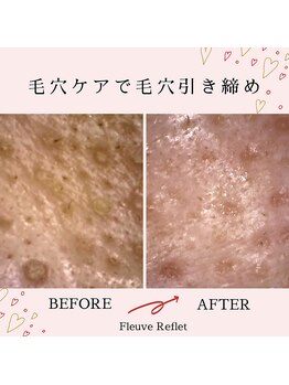 フルーヴ ルフレ(Fleuve Reflet)/変化する毛穴☆★☆