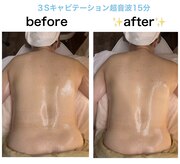 スキンフェイス(skin face)