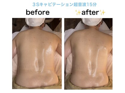 スキンフェイス(skin face)の写真