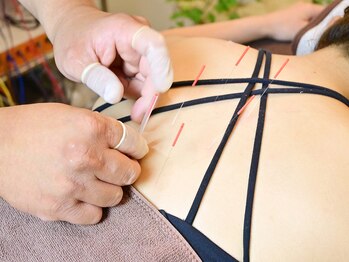 なごみや/背中のハリ