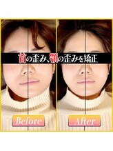 てんてんてんまてん/小顔矯正/骨盤矯正/整体/肩こり