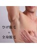 ヒゲあり全身脱毛¥33000⇒¥27500