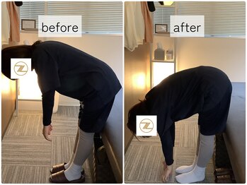 ゼン骨盤整体院(ZEN骨盤整体院)/【30代女性】腰痛