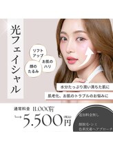 アンサー(ANSWER)/