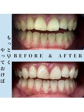 ドルチェ 水戸店(Dolce)/★ before → after ★