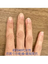 桃の木 吉祥寺店/ネイルケア初回