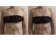 エナリーム(enarym)/骨格から姿勢改善