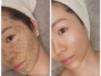 ソアラオーガニック(soara organic)の写真/【美容業界大注目!】もちもち毛穴レス韓国肌が叶う！ハーブピーリング×艶肌WAX