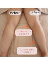 インナーライト(Inner-Light)/＊Before&After＊