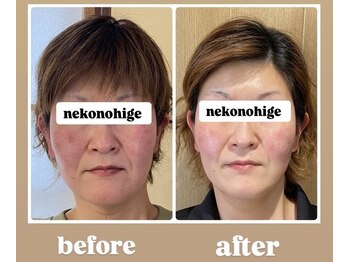 ねこのひげ/ビフォーアフター