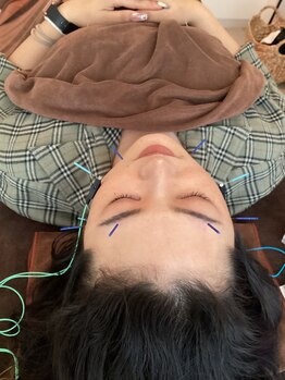 ハリファ鍼灸院 横浜関内院(HariFa鍼灸院)/美容鍼